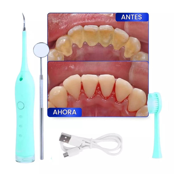 REMOVEDOR ELECTRICO DE CALCULOS DENTALES